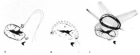 fig18-10.gif