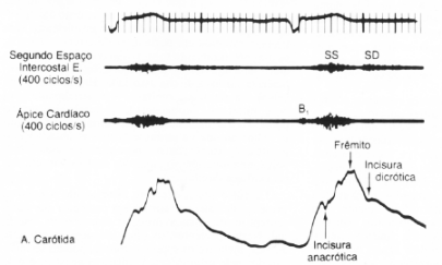 fig19-03.gif