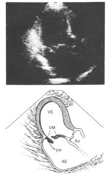 fig24-04.gif