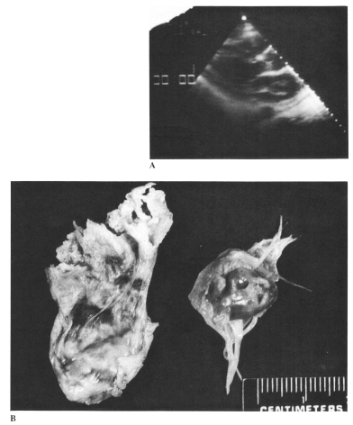 fig24-10.gif