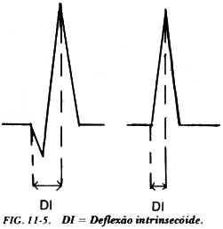 fig11-5.gif