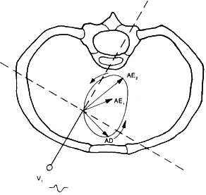 fig13-16.gif