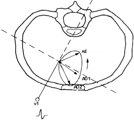 fig13-6.gif