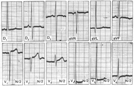 fig15-7.gif