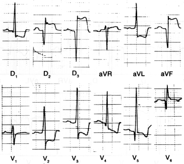 fig20-23.gif
