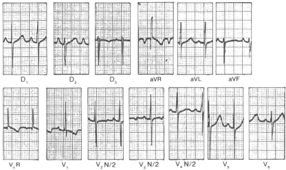 fig24-3.gif