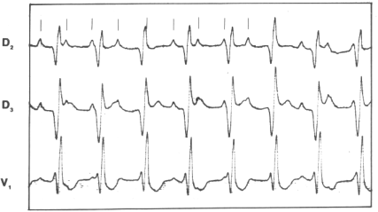 fig28-10.gif