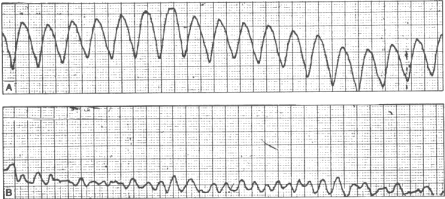 fig30-13.gif