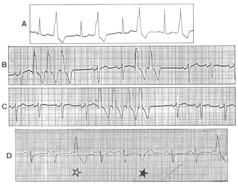 fig31-2.gif