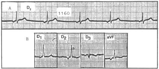 fig32-1.gif