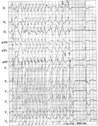 fig34-11.gif