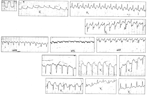 fig35-1.gif