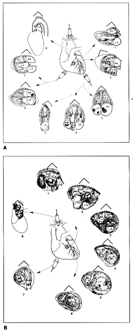fig 2-2-a.gif (51312 bytes)