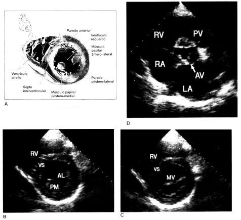 fig 2-4.gif