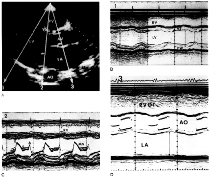 fig 2-8.gif (95995 bytes)