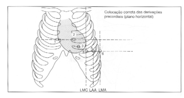 Exerccio 44