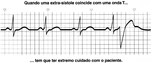Exercício 110