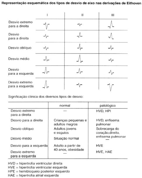 Tipos de Desvio de Eixo