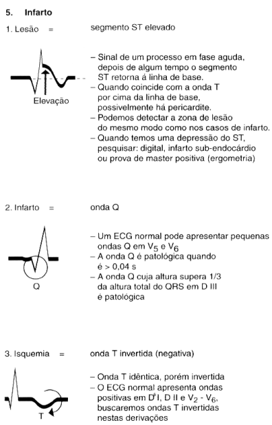 Infarto card�aco: est�dio e localiza��o