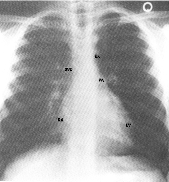 fig02-11.gif