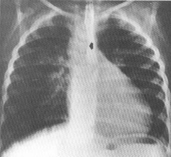 fig02-12.gif