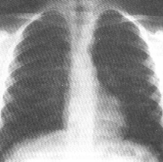 fig02-15.gif
