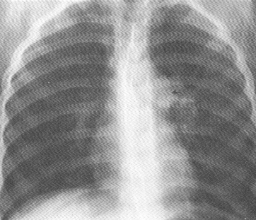 fig02-16.gif