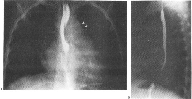 fig02-28.gif