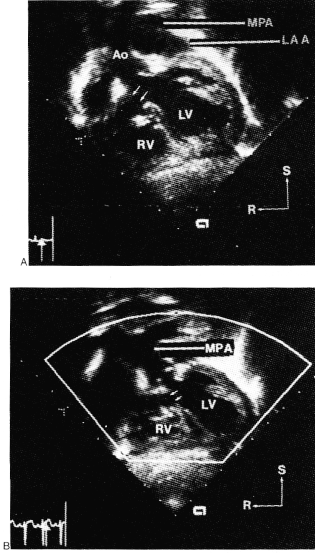 fig04-3.gif