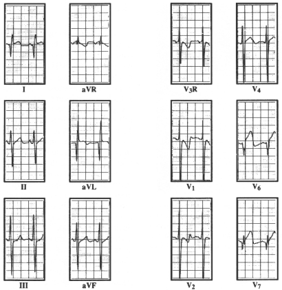 fig12-4.gif