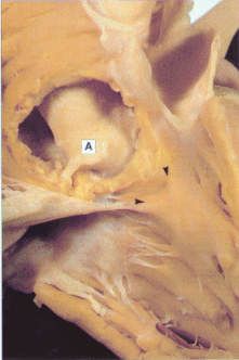 fig01-14a.gif