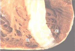 fig02-5.gif