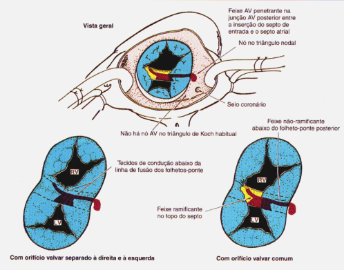 fig06-15.gif