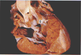 fig15-3a.gif